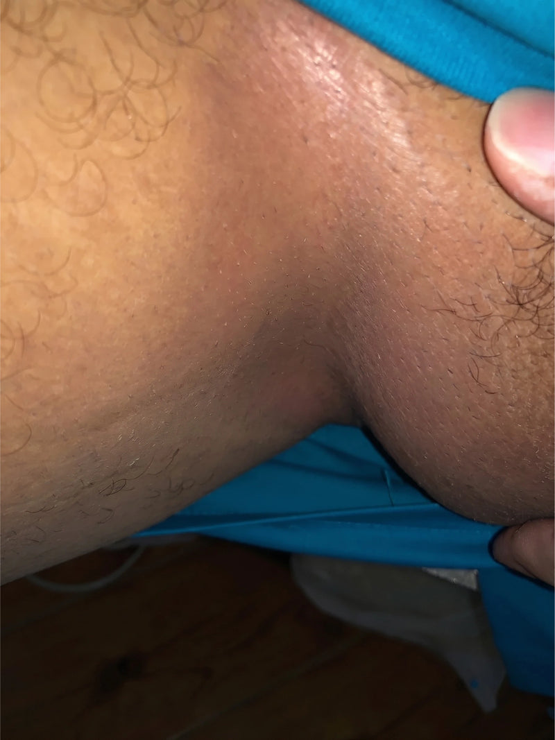 After