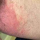 Recurring Irritation