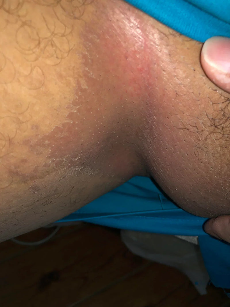 Before