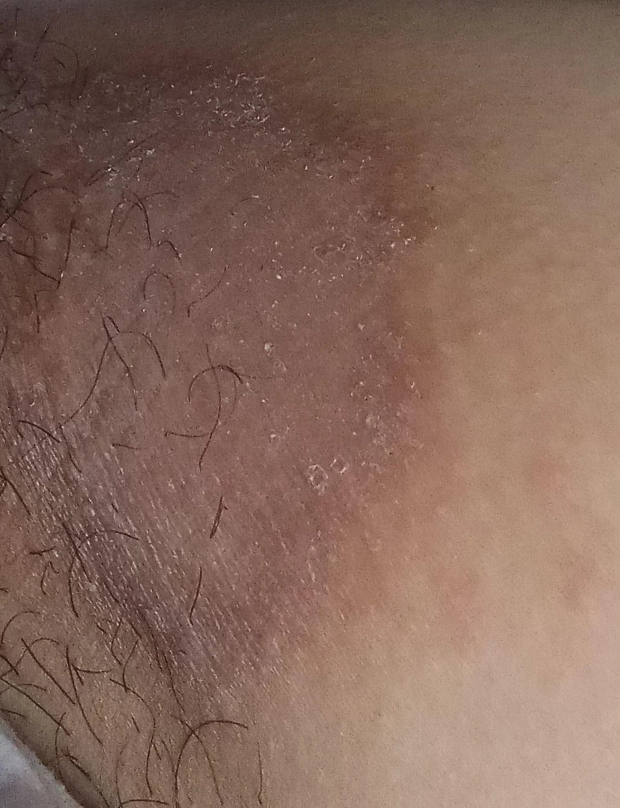 Recurring Irritation